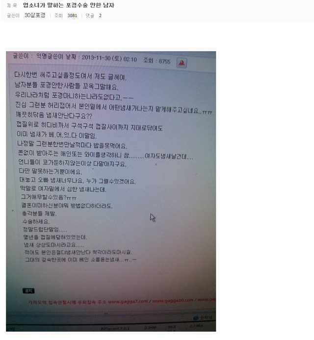 프로가 말하는 포경 안한 남자 | 인스티즈