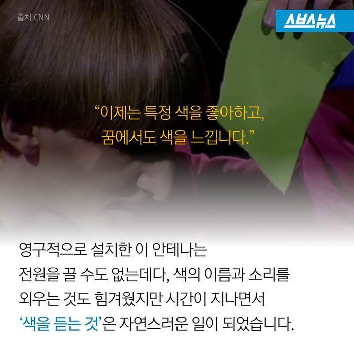  스스로 사이보그가 된 남자 | 인스티즈