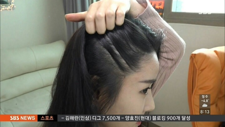 탈모가 고민인 여성 모델 | 인스티즈