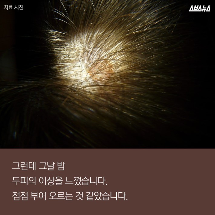 염색약 바르는데 피부가 부어오른 이유 | 인스티즈