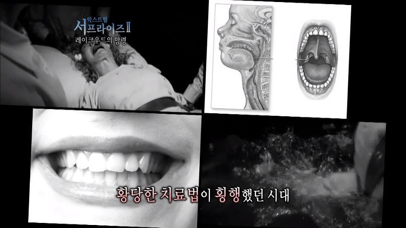[서프라이즈] 잘못된 수술 레이크우드의 망령.jpg | 인스티즈