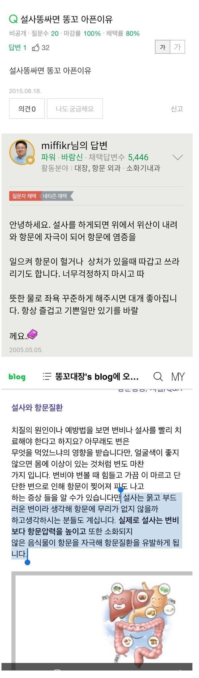설사하면 항문통증있는이유 | 인스티즈
